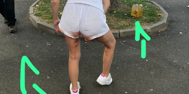 „M-a pus să mă dau cu benzină, după ce am zbierat”. Pățania unei tinere după ce nu a ținut cont de acest lucru!