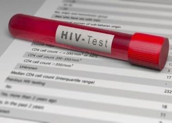 România, subdiagnosticată la HIV. Medic: „Avem mai multe cazuri decât cele raportate”