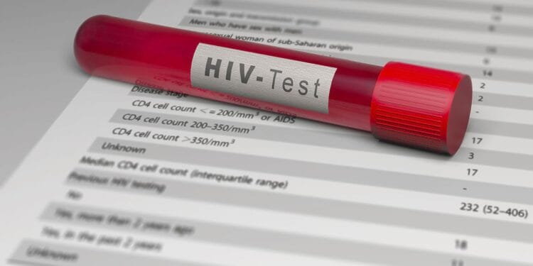 România, subdiagnosticată la HIV. Medic: „Avem mai multe cazuri decât cele raportate”